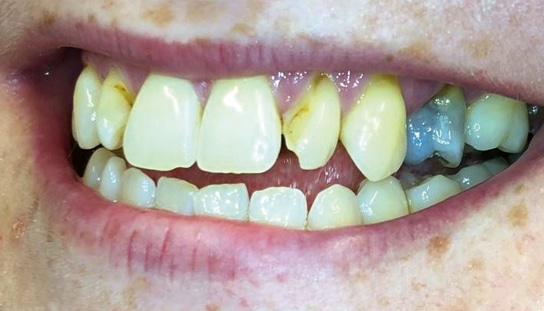 Before - Montpelier Dental Care