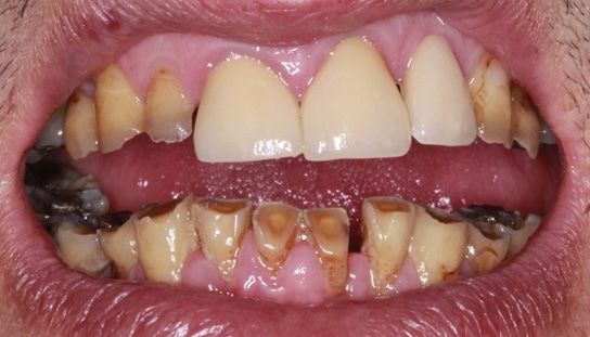 Before - Montpelier Dental Care