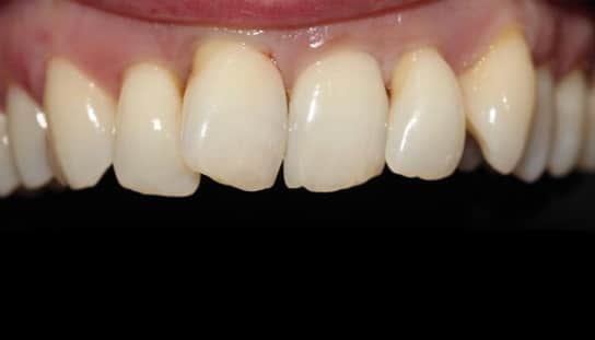 Before - Montpelier Dental Care
