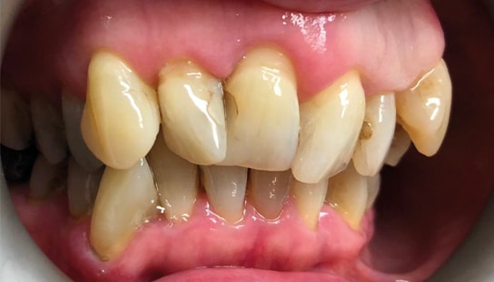 Before - Montpelier Dental Care