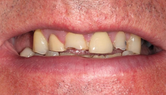 Before - Montpelier Dental Care